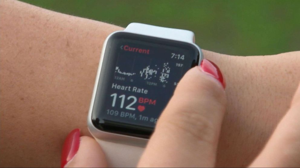 Apple की स्मार्ट वॉच बचाती है लोगों की जान, शख्स ने बताया कैसे