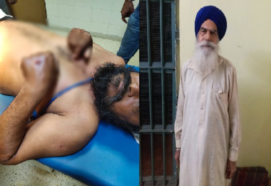 पारिवारिक विवाद में बड़े भाई ने छोटे भाई पर चाकू से किया हमला, नशा मुक्ति का इलाज कराने गए थे अस्पताल