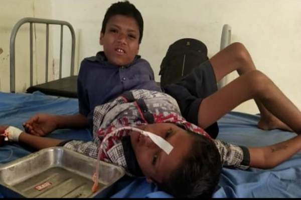 जन्म से ही जुड़े जुड़वा बच्चों को लगी बुरी लत, खाई कीटनाशक दवाई…