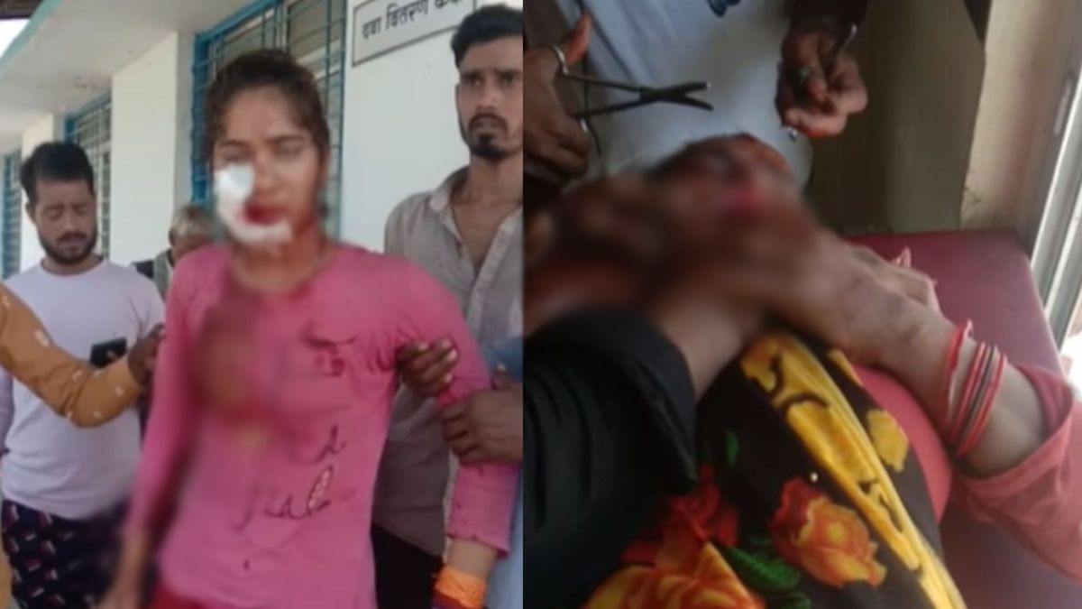 मां-बेटी पर कुल्हाड़ी से हमला: घर पर पत्थर फेंकने से मना करने पर 2 बदमाशों ने किया अटैक, आरोपियों की तलाश जारी