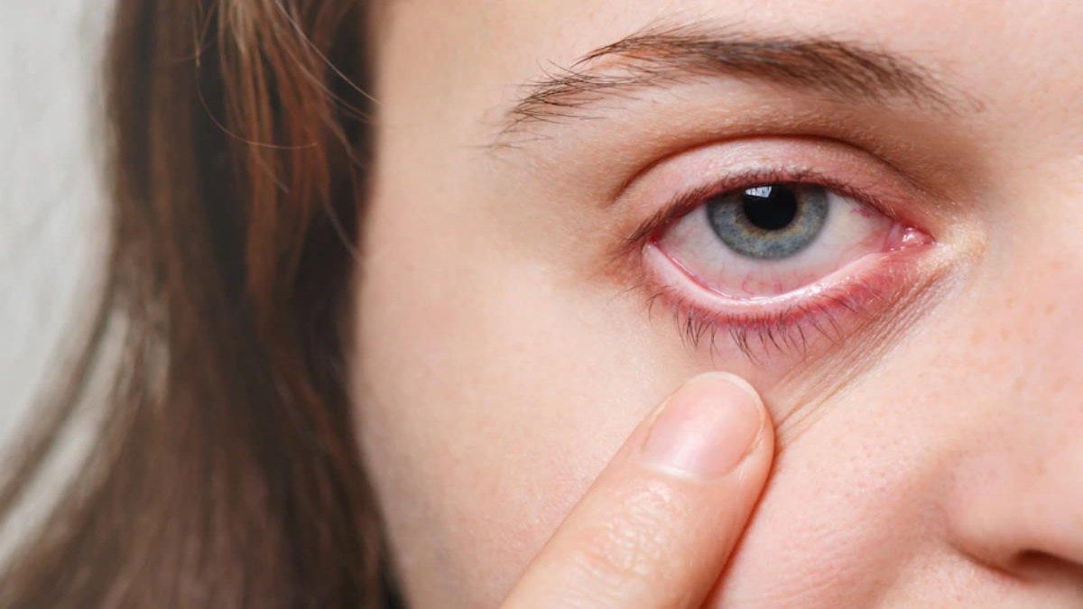 Dry Eyes: ज्यादा देर तक लैपटॉप और मोबाइल देखने से आंखें हो जाती हैं ड्राई, इन टिप्स से मिलेगा फायदा