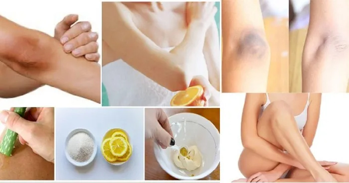 Beauty Tips: घुटने और कोहनी का कालापन दूर करें अपनाएं ये घरेलू उपाय, नहीं लगाना पड़ेगा पार्लर का चक्कर