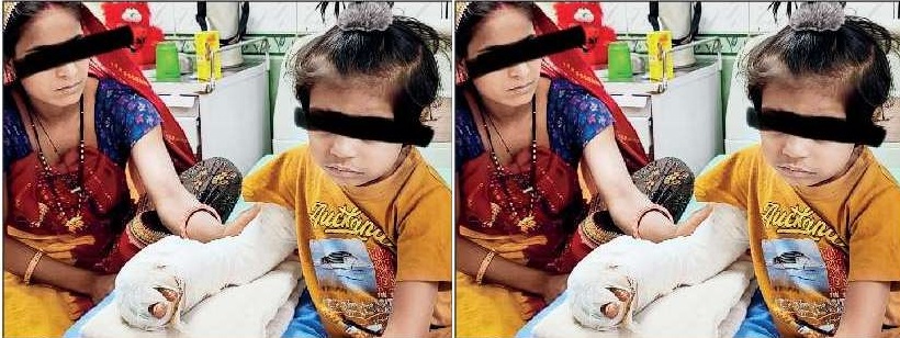 9 घंटे की सर्जरी… डॉक्टरों ने पैर की उंगली को हाथ में किया ट्रांसप्लांट…