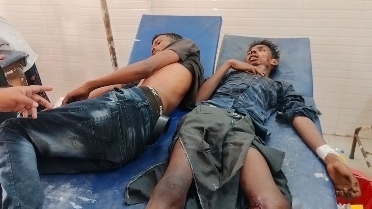 CG Accident : दो बाइकों में जबरदस्त भिड़ंत, एक नाबालिग की मौत, 4 गंभीर रूप से घायल