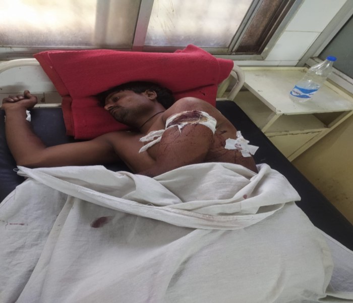तीन बदमाशों ने युवक पर किया जानलेवा हमला: घायल जिला अस्पताल में भर्ती, मामले की जांच में जुटी पुलिस