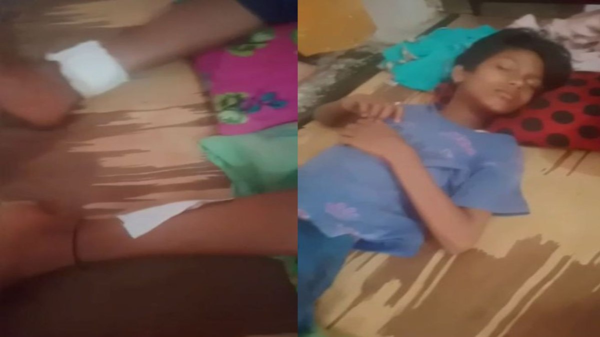 बच्ची के पैर में लगी गोली: रात में आंगन में मां के साथ सोई थी, तभी किसी ने की फायरिंग, जांच में जुटी पुलिस