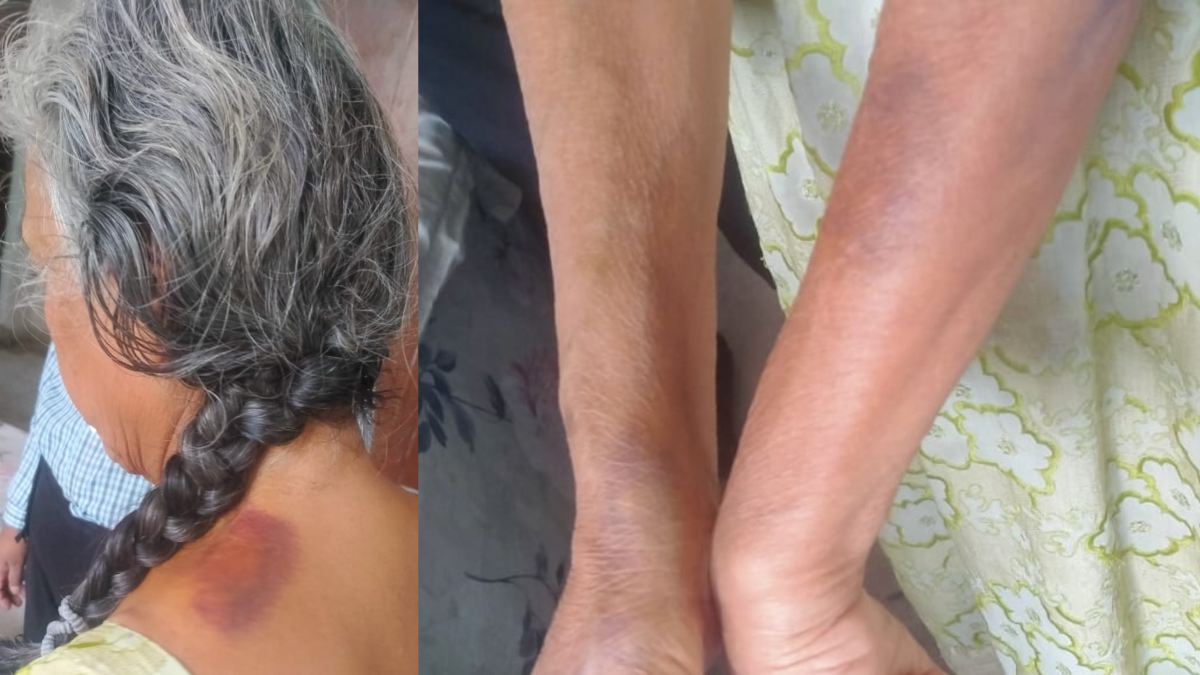 राजधानी के हाई प्रोफाइल परिवार में संपत्ति विवाद: बेटी ने दिखाया कलयुगी अवतार, तीन महीने तक बुजुर्ग माता-पिता को बंधक बनाकर पीटा