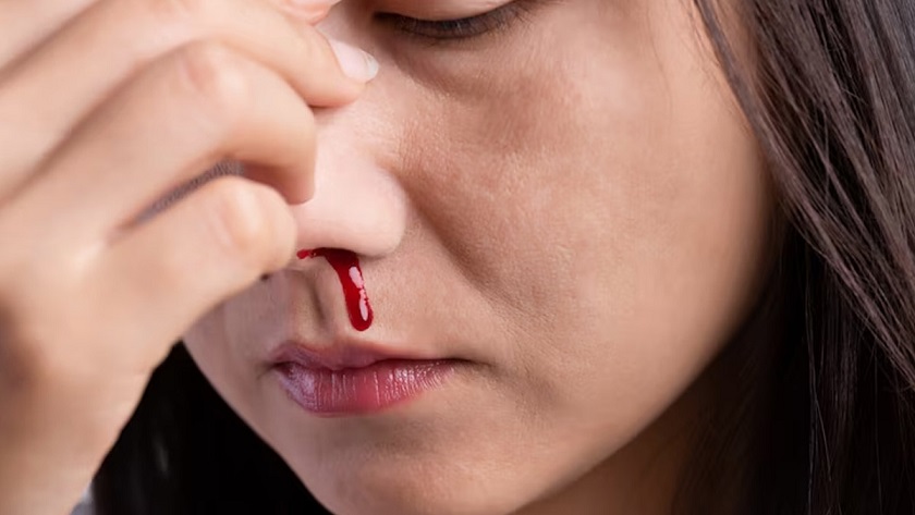 Nose Bleeding In Summer-गर्मी में कई लोगों को होती है नाक से खून आने की समस्या, अगर आपको भी है ये शिकायत तो अपनाएं ये घरेलू उपाय