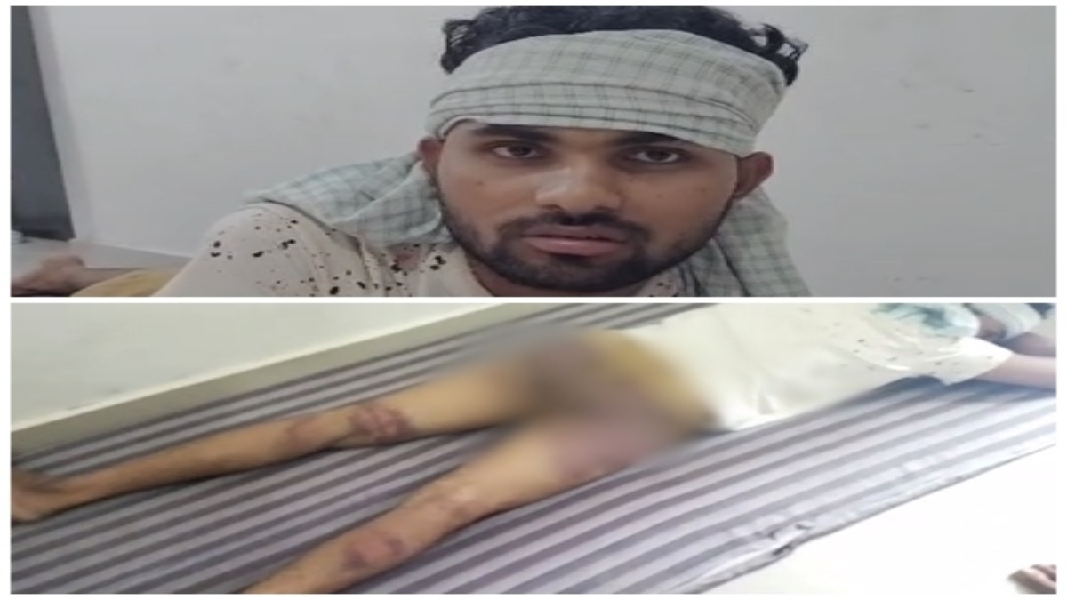MP में पुलिस की बर्बरता ! युवक को बेरहमी से पीटा, तीन पुलिसकर्मी लाइन अटैच  
