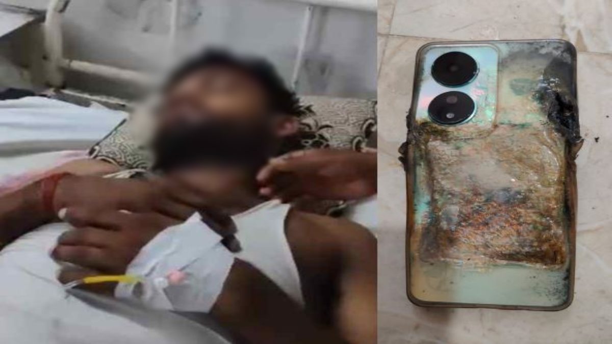 सावधान..! युवक की जेब में फटा नया मोबाइल, गंभीर रूप से घायल, अस्पताल में भर्ती