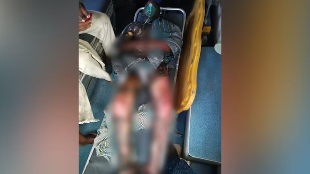 दोस्त बने जानी दुश्मन ! छात्र को साथियों ने जिंदा जलाया, पुलिस हिरासत में 3 हैवान