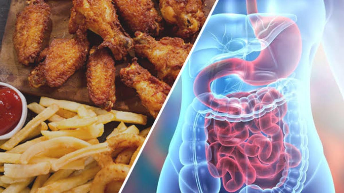 Health News: ये सभी खाद्य पदार्थ आंत को पहुंचाते है बहुत नुकसान, कम से कम करें सेवन