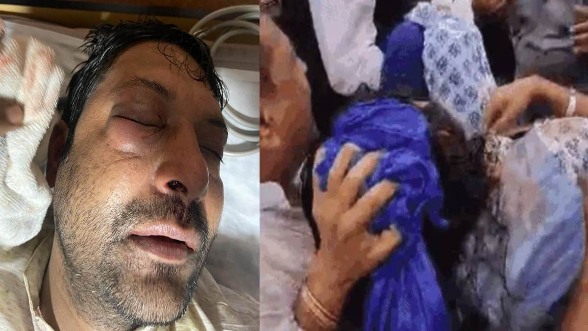 CM हाउस घेरने जा रहे कांग्रेसियों पर वाटर कैनन की बौछार: जिला अध्यक्ष की आंख और महिला का फूटा सिर, कमलनाथ बोले- सरकार ने कार्यकर्ताओं से की बर्बरता