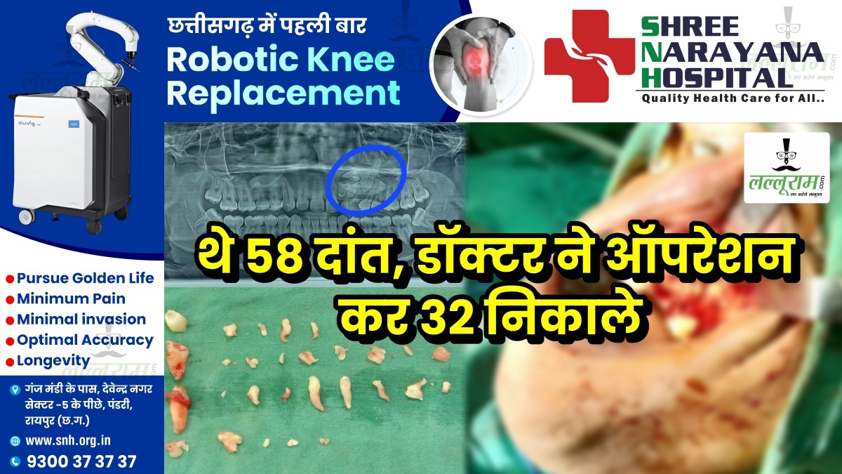Raipur News: 14 साल के बच्चे के थे 58 दांत, डॉक्टर ने ऑपरेशन कर 32 दांत निकाले