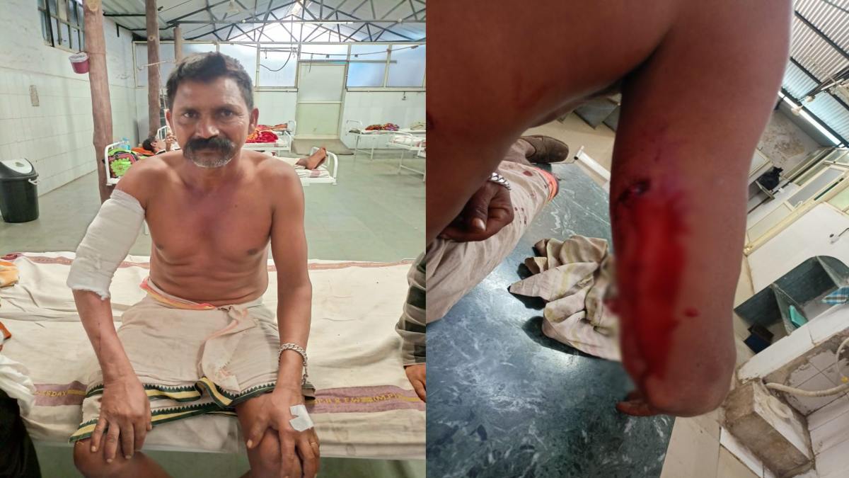 MP में खेत में बुआई करने गए दंपत्ति पर जंगली जानवर ने किया हमला: तेंदुआ होने की आशंका, ग्रामीणों में दहशत का माहौल