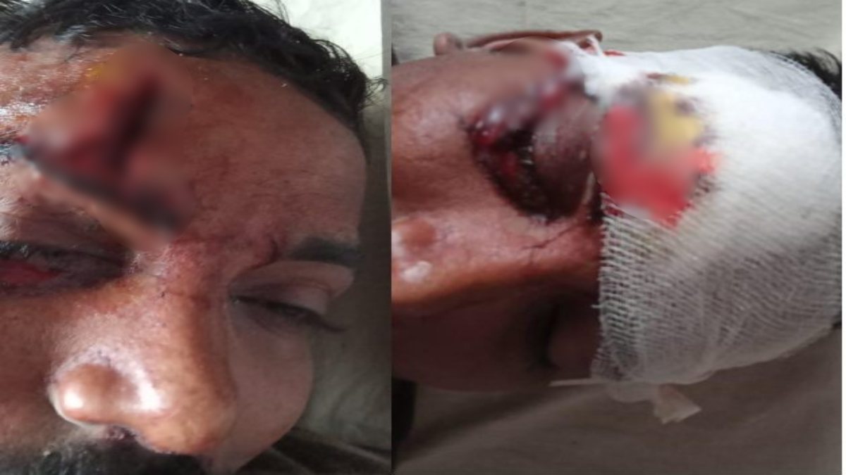 CG NEWS : ड्यूटी पर तैनात जवान पर अचानक गिरा पेड़, गंभीर रूप से हुआ घायल