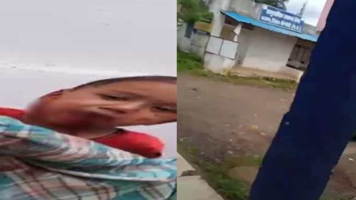 MP में मासूम के चेहरे को कुत्ते ने बुरी तरह नोंचा: अस्पताल में नहीं मिले डॉक्टर, दर्द से कराह रहे बच्चे को गोद में लेकर भटकते नजर आए परिजन, VIDEO वायरल