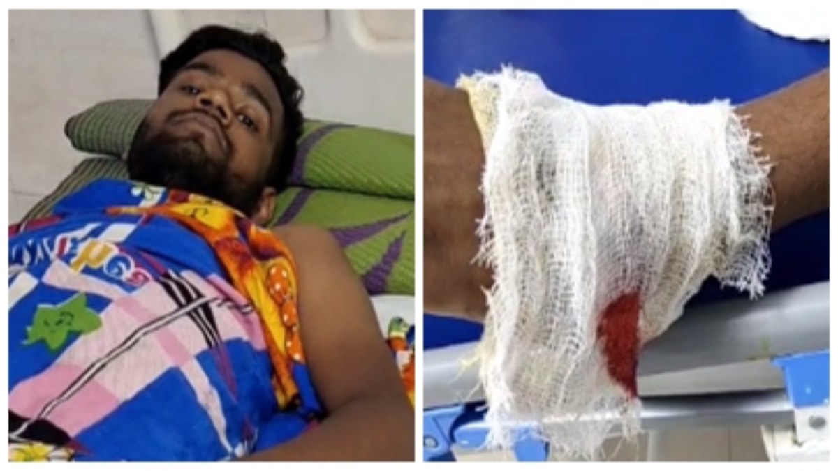 MP CRIME: दोस्त का जन्मदिन मना रहे युवक को बाइक सवार बदमाशों ने मारी गोली, इलाके में रंगदारी जमाने वारदात को दिया अंजाम