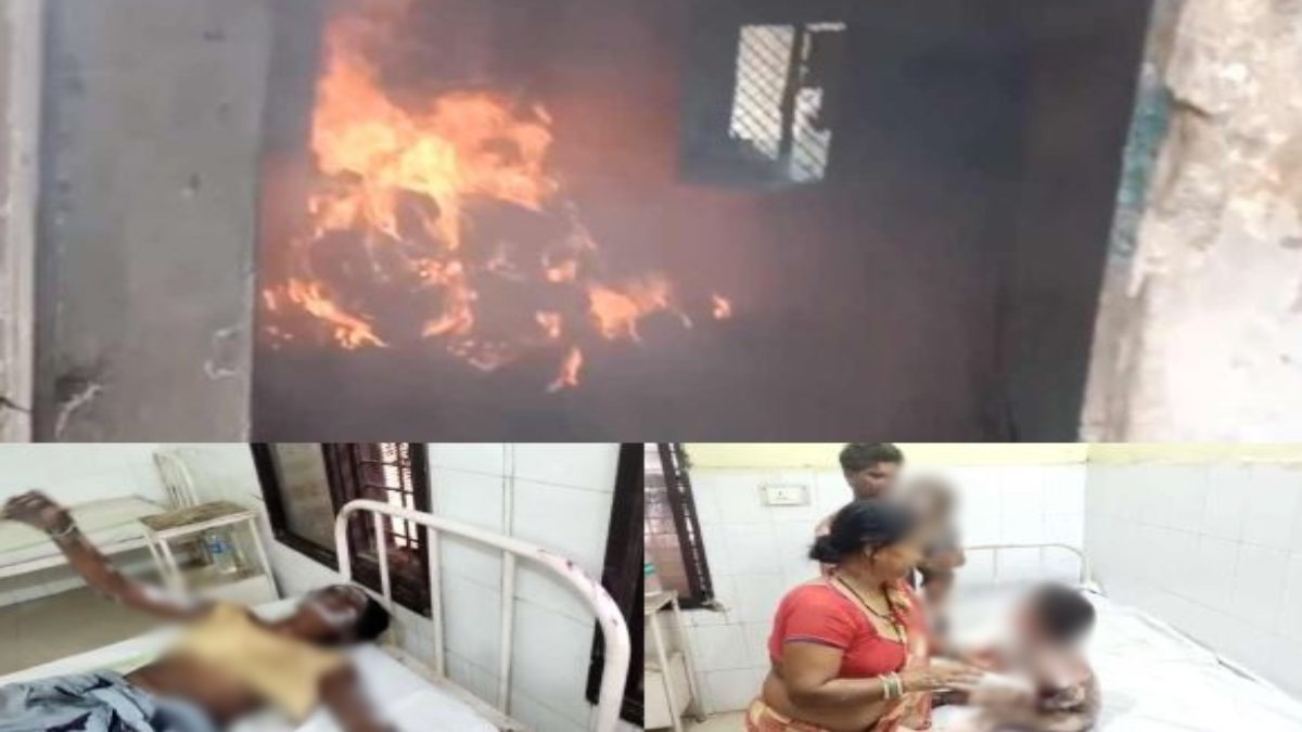 आग में झुलसे 2 मासूम बच्चों की मौत: माता-पिता का इलाज जारी, कल सिलेंडर लीक होने से घर में लगी थी आग