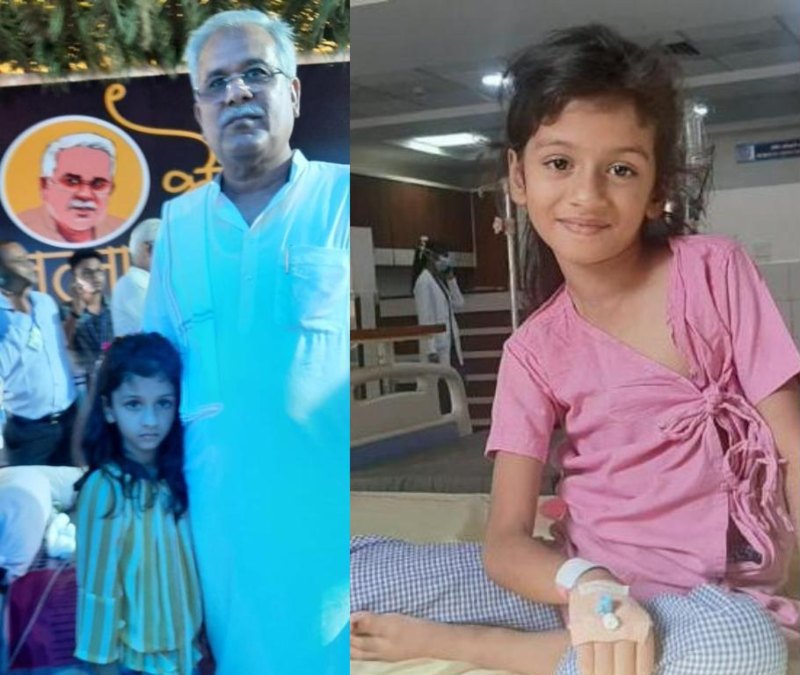 CM बघेल से परिवार ने लगाई थी गुहार, एम्स में हुआ सफल कॉक्लियर इंप्लांट, 8 साल बाद बिटिया ने सुनी मां की आवाज…