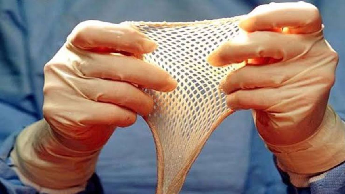 SKIN BANK : छत्तीसगढ़ में यहां हैं स्किन बैंक, आग से झुलसे मरीजों को मिलती है नई त्वचा, ऐसे होता है त्वचा दान