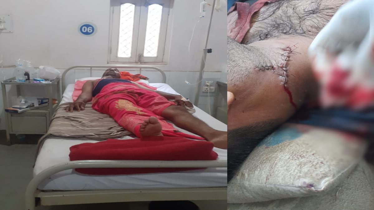MP CRIME: बदमाश ने दुकानदार के गले में घोंपा चाकू, इस बात से नाराज होकर वारदात को दिया अंजाम