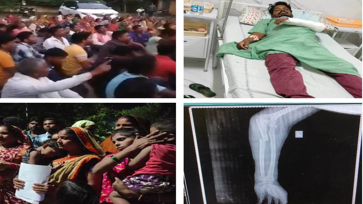 मारपीट मामले में पीड़ित पर कार्रवाई को लेकर भड़के ग्रामीण, कांग्रेस विधायक के संरक्षण के चलते एक्शन नहीं लेने का लगाया आरोप, थाने में की जमकर नारेबाजी