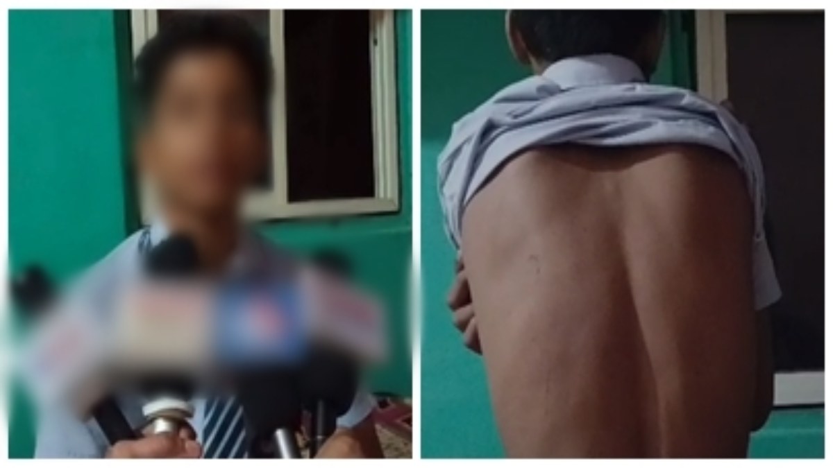 स्कूल टीचर ने की क्रूरता की हदें पार: मामूली बात पर छात्र की लात-घूसों से की पिटाई, परिजनों में आक्रोश  