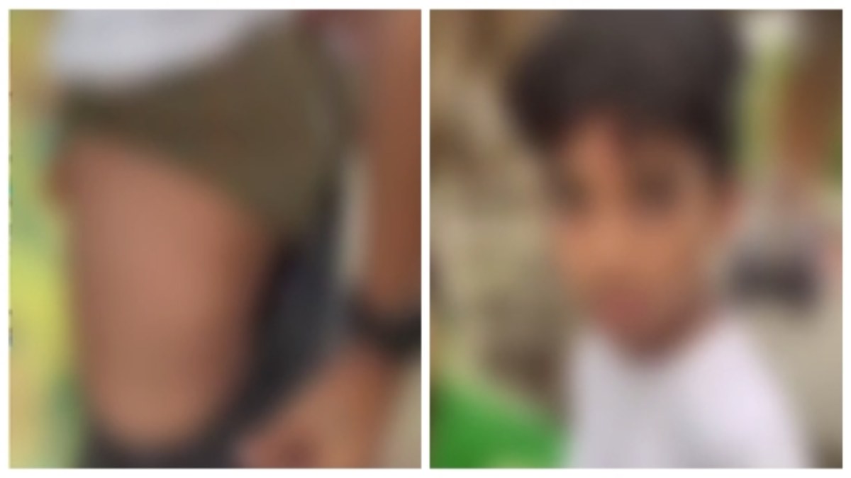 मोबाइल चलाने पर वार्डन ने छात्र को बेरहमी से पीटा: पैर पर आए चोट के निशान, परिजनों ने पुलिस में की शिकायत   
