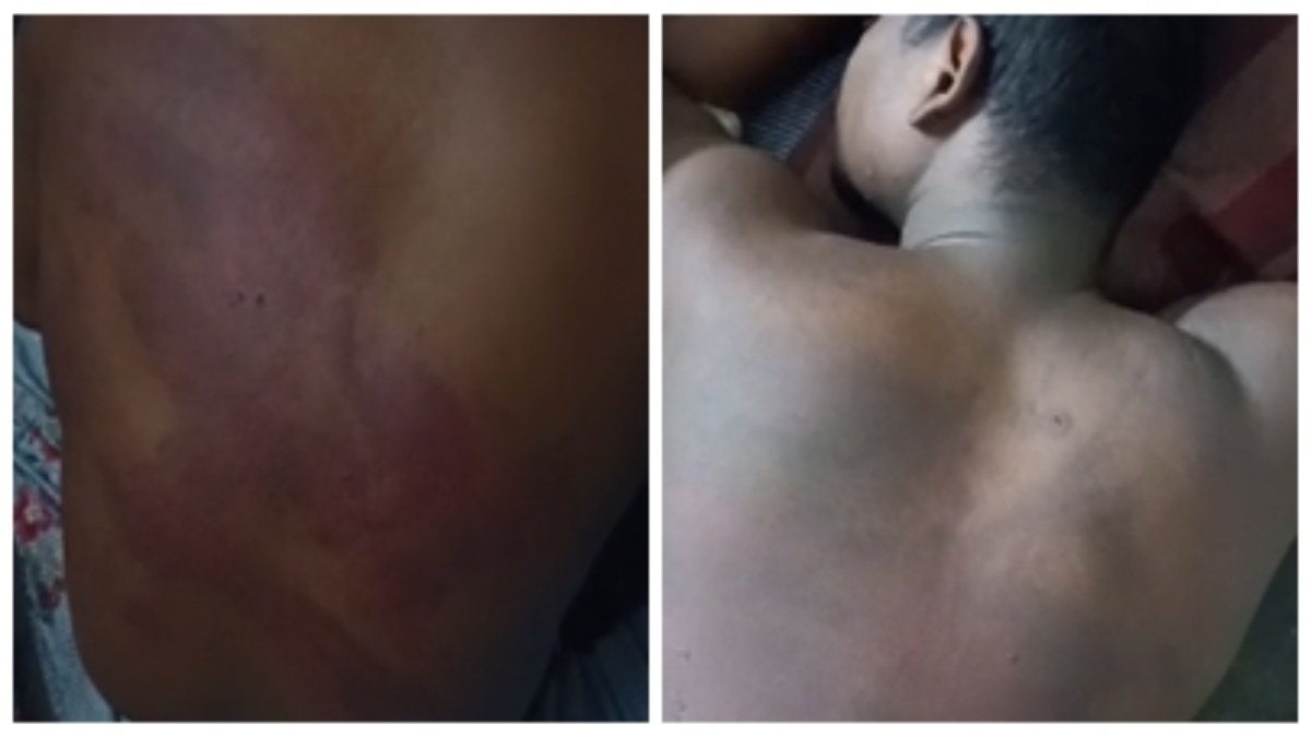 रोजगार के लिए गुजरात गए एमपी के युवकों की पिटाई: चोरी का आरोप लगाकर बरपाया कहर, VIDEO वायरल