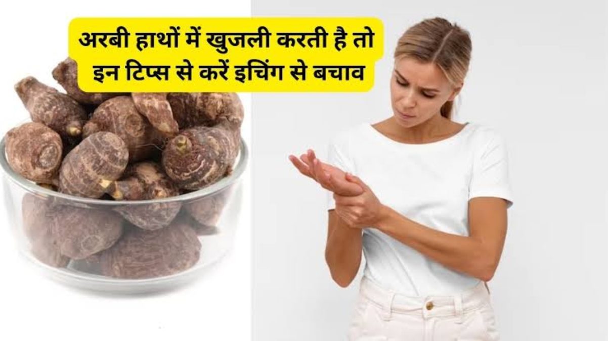 Kitchen Hack : अरबी खाने में लगता है बहुत टेस्टी, लेकिन छिलने से हाथों में खुजली, तो ये Tips आएंगे काम …
