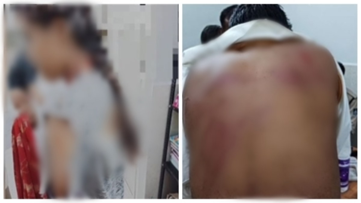 नाबालिग किशोरी के साथ छेड़छाड़: मारपीट कर फाड़े कपड़े, परिजनों को भी पीटा, पुलिस पर लगे गंभीर आरोप 