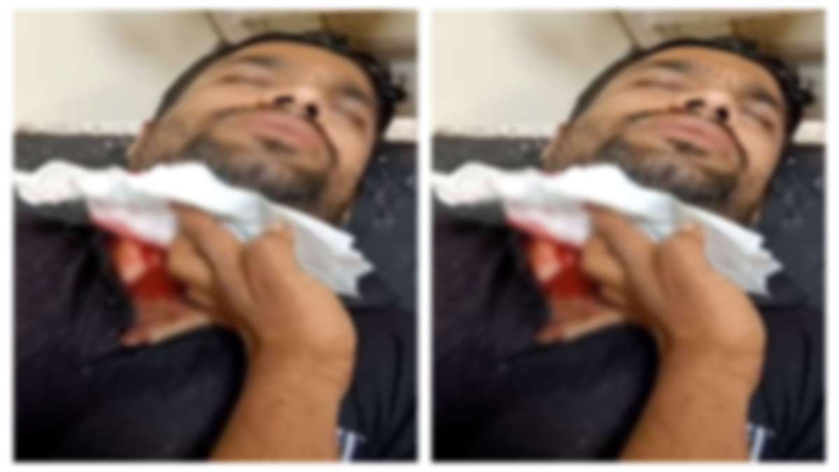 भोपाल में युवक पर जानलेवा हमला: शराब के लिए पैसे नहीं देने पर गले में मारा चाकू, अस्पताल में भर्ती, आरोपी पर पहले से ही कई केस दर्ज