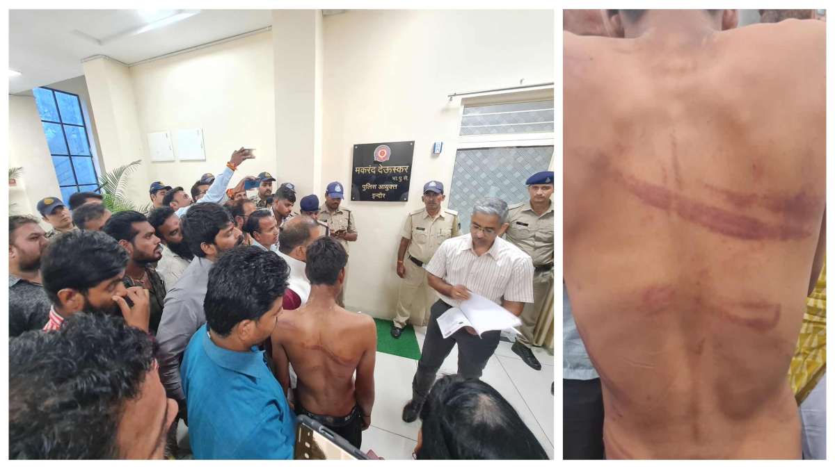मोटर सुधारने से मना करने पर पूर्व कांग्रेसी सरपंच ने की मारपीट: युवक को किडनैप कर बेल्ट से पीटा, पिता से मांगे 3 लाख