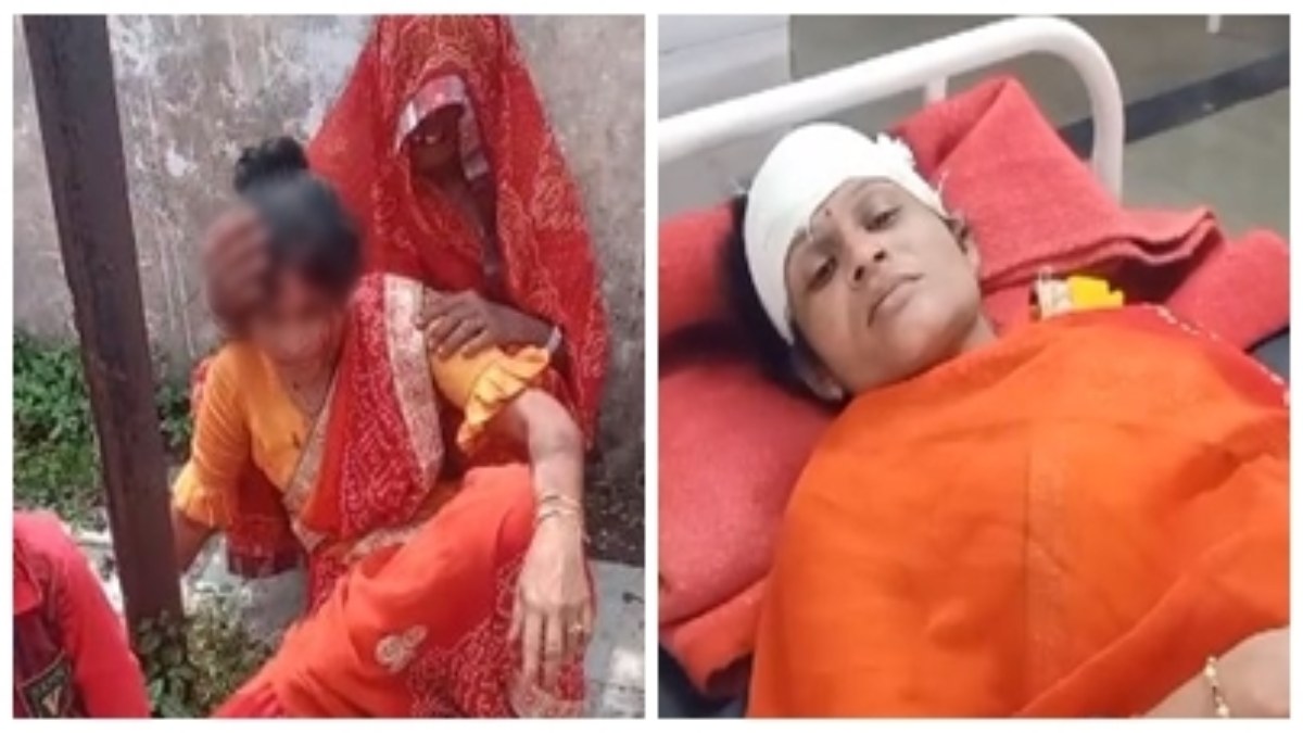 MP में महिलाओं पर जानलेवा हमला: 3 गंभीर रूप से घायल, बीजेपी नेता के भतीजे और परिवार पर लगा आरोप, पुलिस ने मामूली धाराओं में दर्ज किया मामला