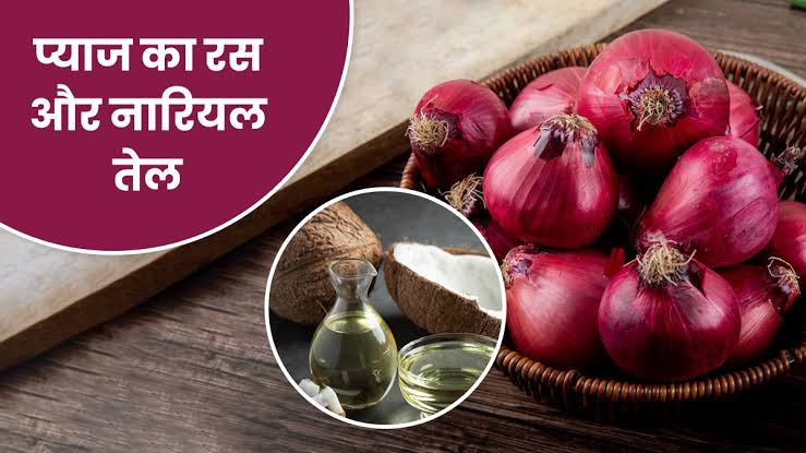 Hair Care Tips: नारियल तेल में ऐसे मिलाएं प्याज का रस, बालों के लिए साबित होगा वरदान… ये सभी समस्याएं होगी दूर