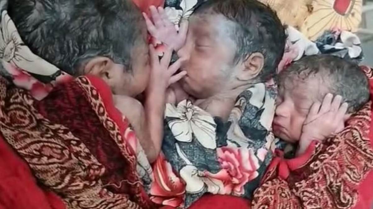 गर्भवती महिला ने एक साथ 3 बच्चों को दिया जन्म, मां और नवजात स्वस्थ