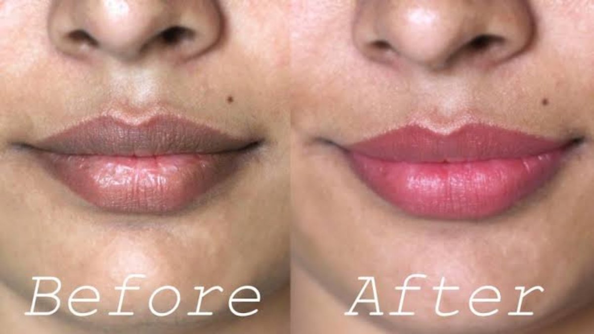 Lips Care Tips : होंठों का गहरा रंग कम कर देता है चेहरे की खूबसूरती, इससे बचने के लिए अपनाएं ये घरेलू नुस्खें …