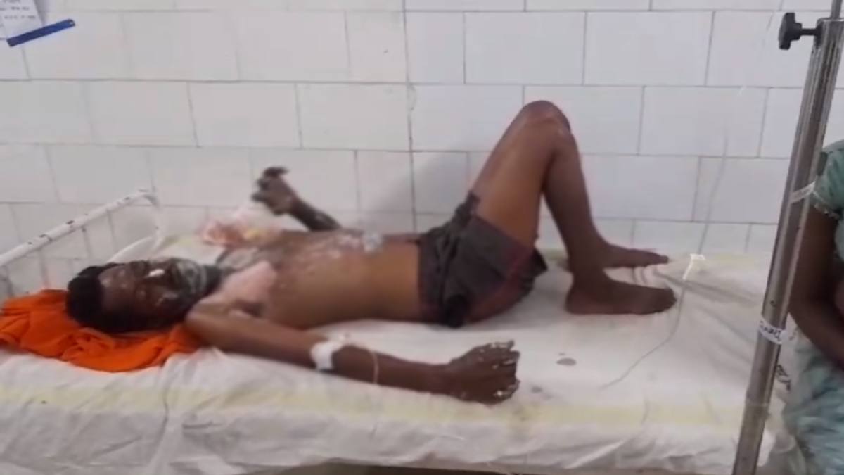 पेट्रोल अटैक: पति ने 100 रुपए मांगा तो पत्नी ने किया आग के हवाले, बुरी तरह झुलसा