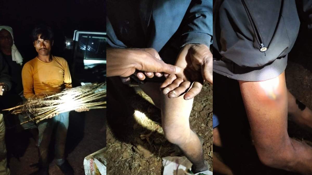 जंगली जनवरों के शिकार के लिए बिछाया था करंटः बाल-बाल बची युवक की जान, झुलसे युवक अस्पताल में भर्ती