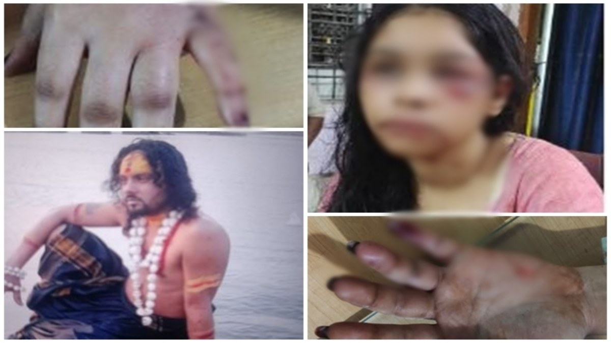 अंधविश्वास की चपेट में पूरा परिवार: मां और भाई ने की हैवानियत, तांत्रिक क्रिया से युवती के दोनों हाथ के साथ जली जुबान