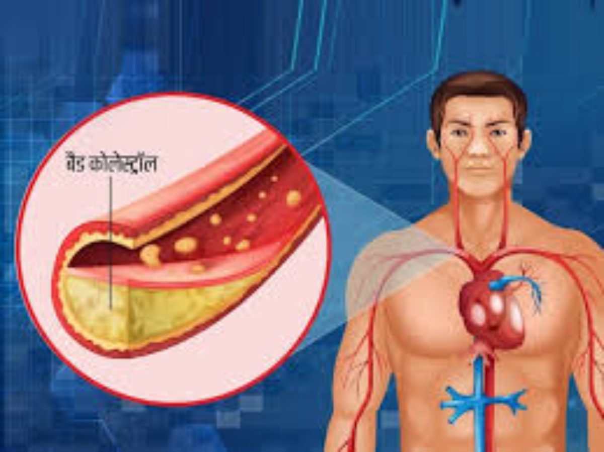 Health Tips: हाई कोलेस्ट्रॉल से बचना है तो इस सीजन में जरूर खाएं ये फल
