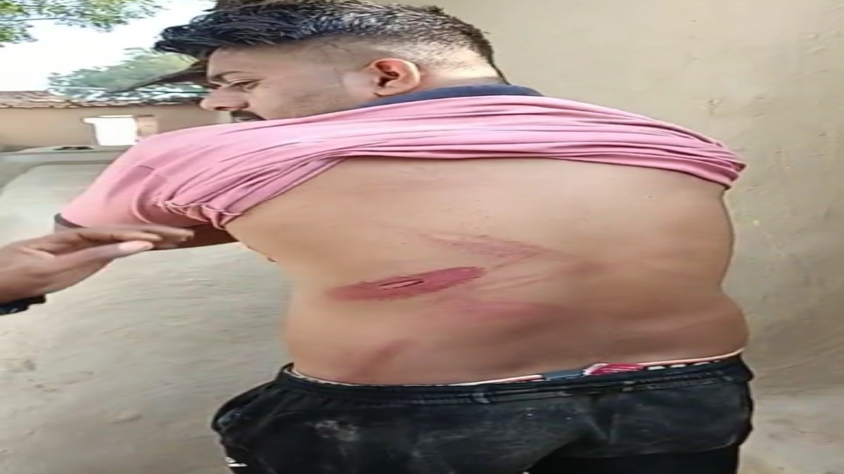 कांग्रेस को वोट देने से मना करने पर जमकर पिटाईः जनपद अध्यक्ष एवं कार्यकर्ताओं के खिलाफ मामला दर्ज