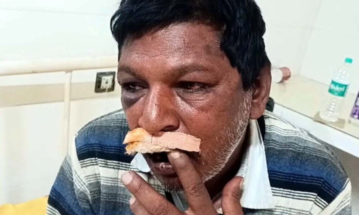 बेटे ने की हैवानियत की सारी हदें पर, अपने ही पिता पर लोहे के पाईप से हमला, वजह जान हो जायेंगे हैरान…