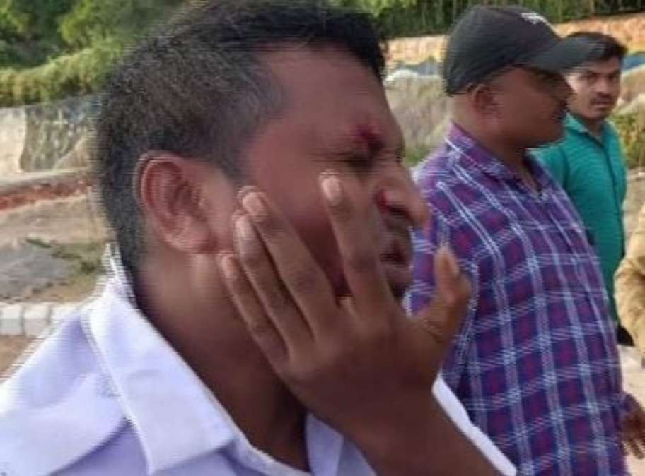 Odisha News: भुवनेश्वर में एक व्यक्ति ने ऑन-ड्यूटी ट्रैफिक पुलिसकर्मी को काट लिया, पीड़ित गंभीर रूप से घायल