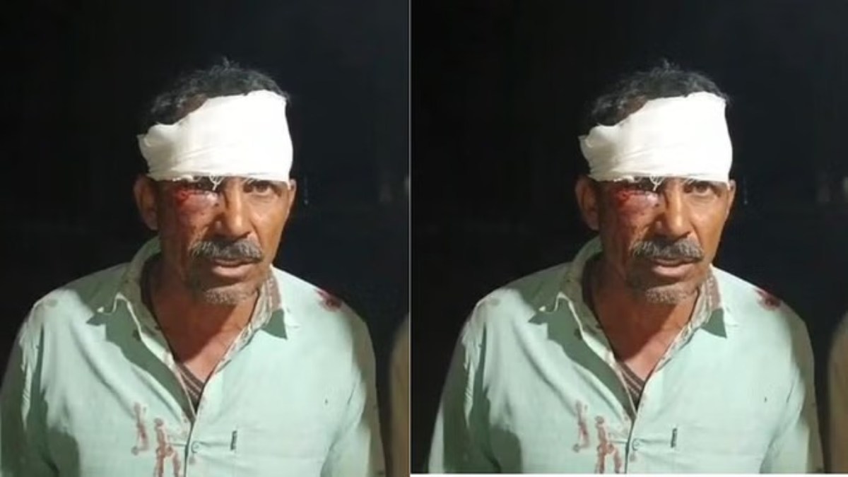 MP: पुलिसकर्मियों पर ग्रामीण ने लगाया मारपीट का आरोप, कोर्ट ने दिए जांच के आदेश