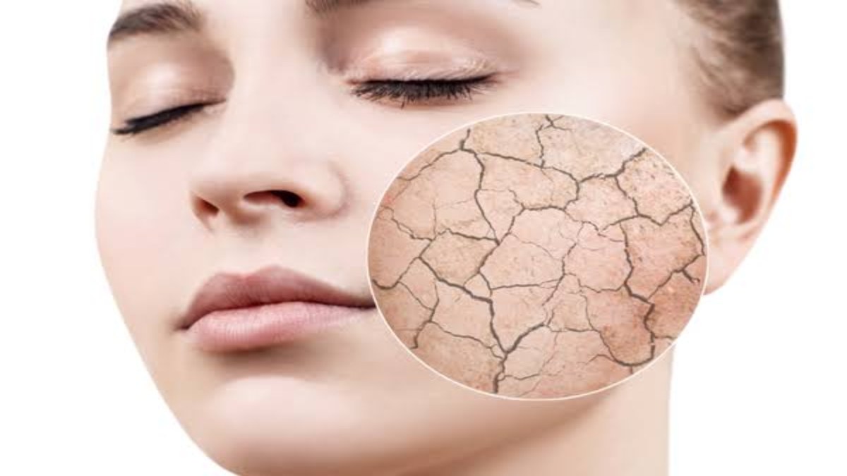 Winter Skin Care Tip : सर्दियों में स्किन हो जाती है बहुत Dry, तो इस तरह रखें ध्यान, नहीं लगेगा रूखापन …