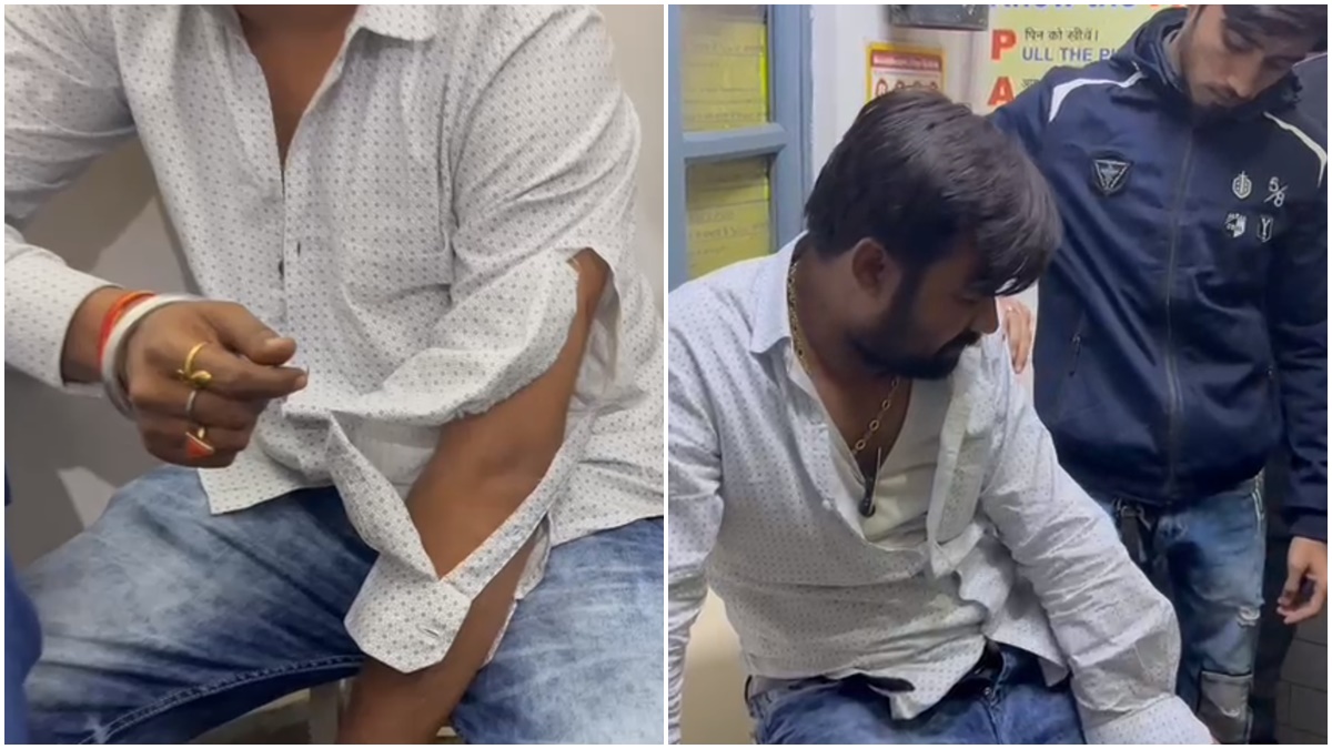 कांग्रेस प्रत्याशी के भतीजे पर हमला: कार रोककर बाइक सवार लोगों ने की मारपीट, चुनाव प्रचार से लौट रहे थे वापस