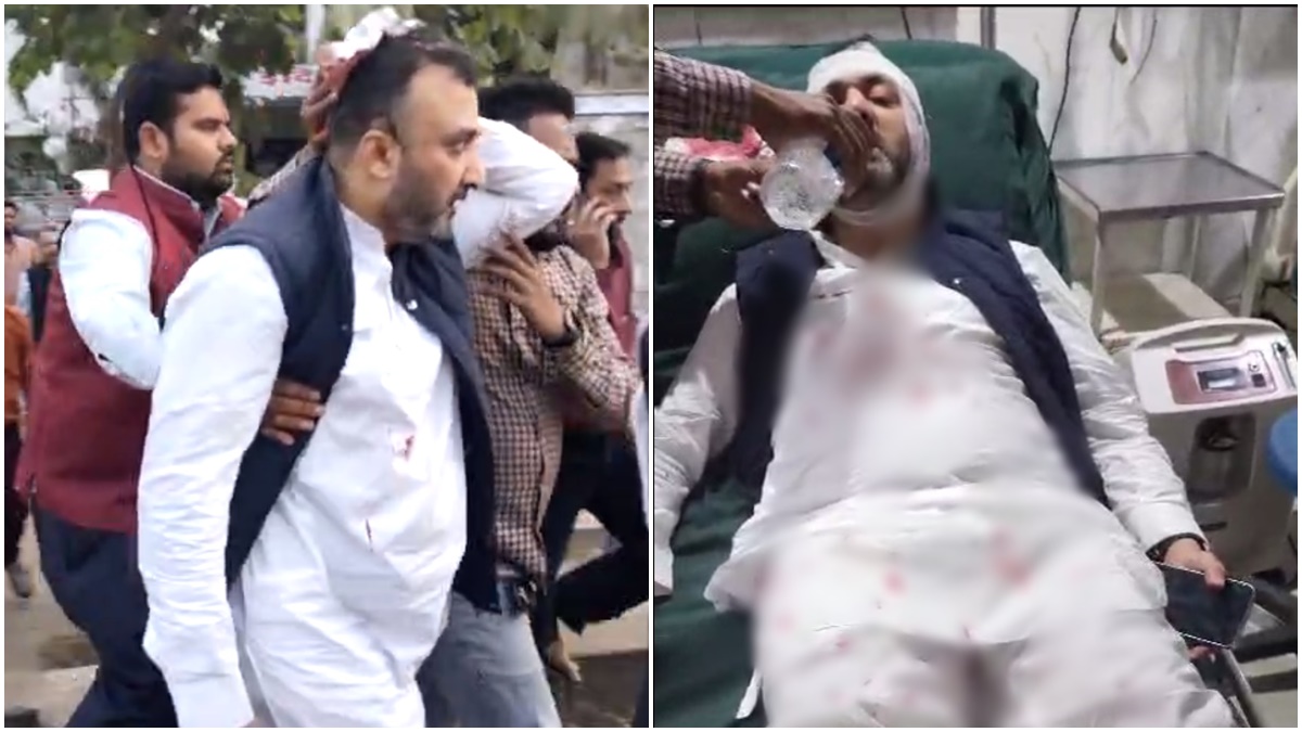 PCC दफ्तर में कांग्रेस के ही दूसरे गुट ने किया था जानलेवा हमला: पूर्व जिला अध्यक्ष समेत इनके खिलाफ FIR दर्ज, जानिये क्या है पूरा मामला