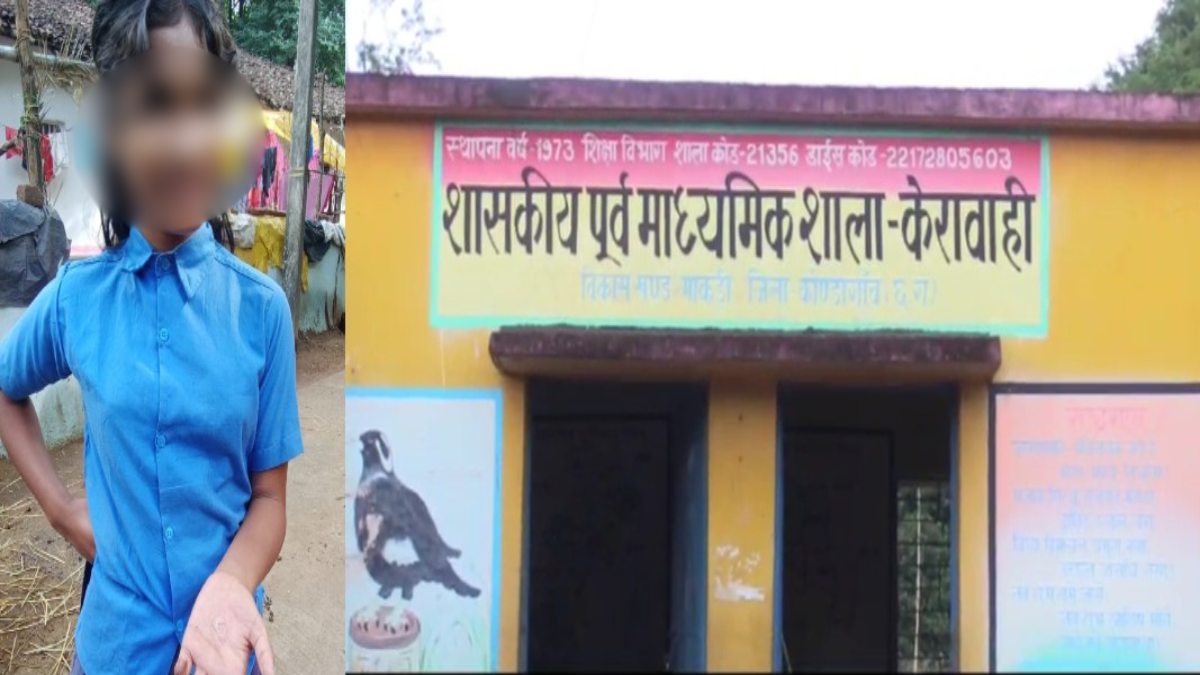 बेरहमी की हद पार ! बच्चे ने शौच कर पानी नहीं डाला, पालक ने लगाया आरोप- शिक्षक ने 25 नौनिहालों के हाथों में डलवा दिया गर्म तेल, अधिकारी कह रहे बच्चों ने ये खुद किया…